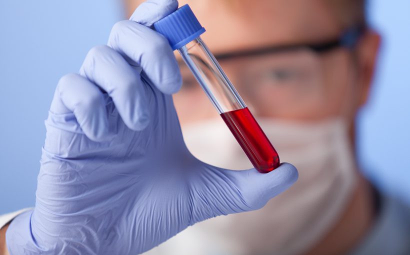 Analityk laboratoryjny w sterylnym ubraniu trzyma w dłoni fiolkę z krwią pacjenta. /Źródło: 123rf.com