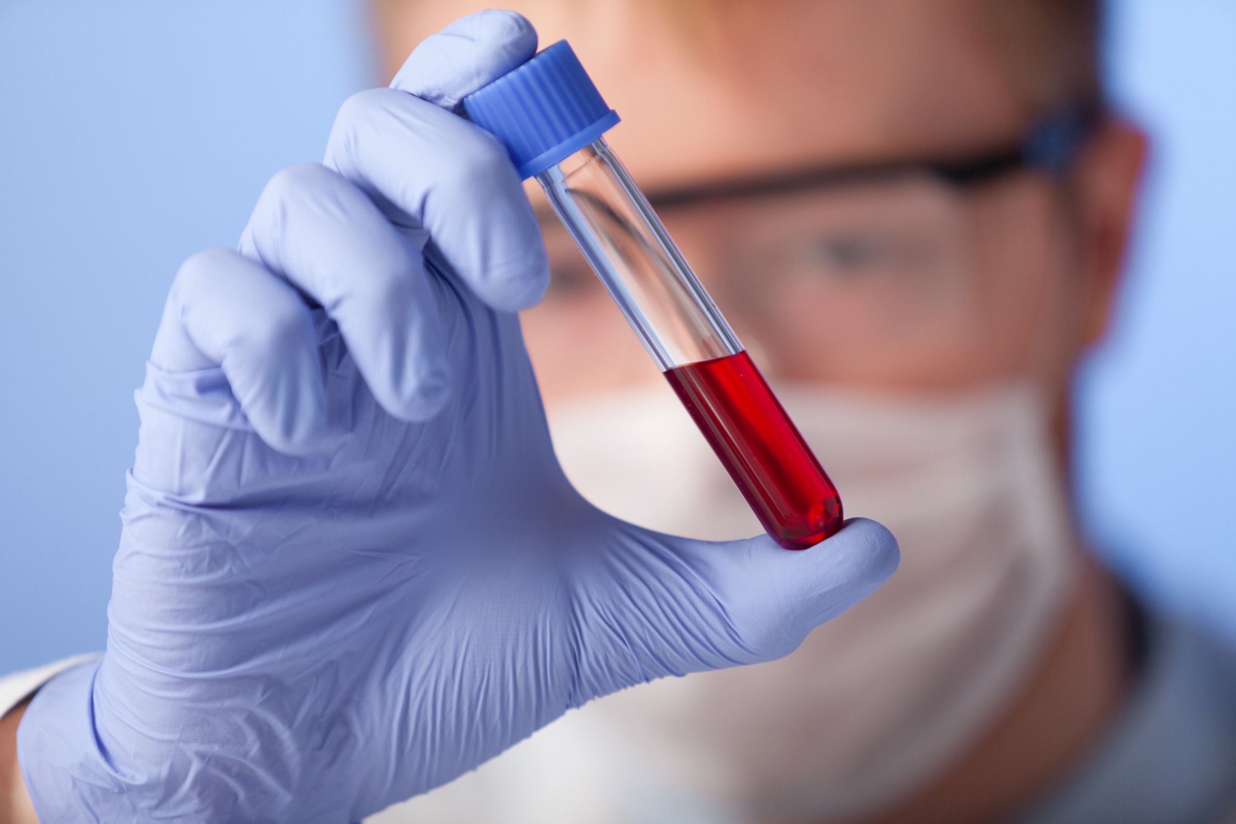 Analityk laboratoryjny w sterylnym ubraniu trzyma w dłoni fiolkę z krwią pacjenta. /Źródło: 123rf.com