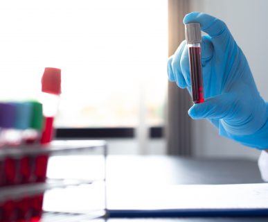 Diagnosta laboratoryjny trzyma w dłoniach probówkę wypełnioną krwią pacjenta, opisuje jej cechy. /Źródło: 123rf.com