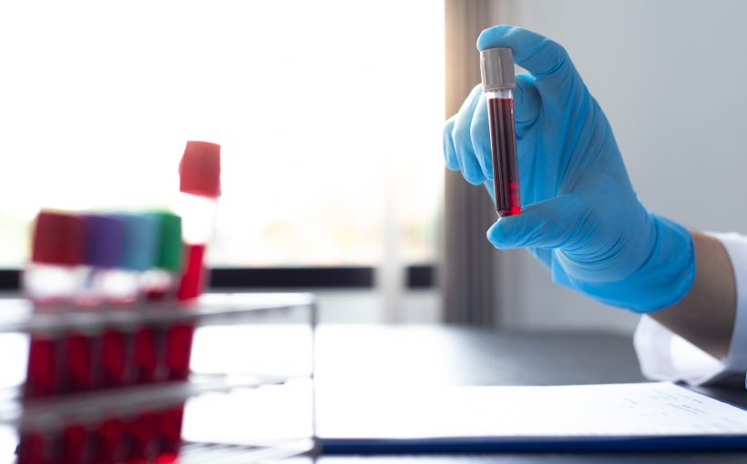 Diagnosta laboratoryjny trzyma w dłoniach probówkę wypełnioną krwią pacjenta, opisuje jej cechy. /Źródło: 123rf.com