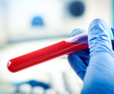 Diagnosta laboratoryjny trzyma w dłoni odzianej w sterylną rękawiczkę, probówkę wypełnioną jasnoczerwoną, wyrazistą krwią. /Źródło: 123rf.com