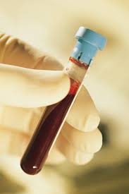 badania laboratoryjne krwi sierpc