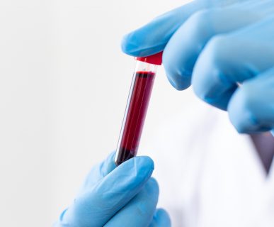 Technik laboratoryjny, odziany w niebieskie, sterylne rękawiczki, trzyma w dłoniach probówkę wypełnioną krwią pacjenta, pobraną w celu diagnostyki. /Źródło: 123rf.com