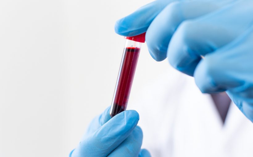 Technik laboratoryjny, odziany w niebieskie, sterylne rękawiczki, trzyma w dłoniach probówkę wypełnioną krwią pacjenta, pobraną w celu diagnostyki. /Źródło: 123rf.com