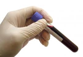 badania laboratoryjne krwi szczecin północ
