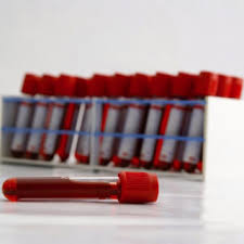 badania laboratoryjne krwi warszawa białołęka