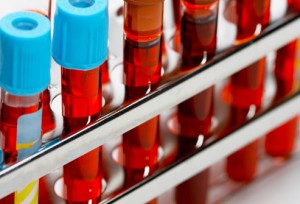 badania laboratoryjne krwi warszawa ochota