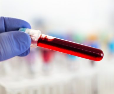 Analityk laboratoryjny trzyma w dłoni odzianej w sterylną rękawiczkę, fiolkę wypełnioną krwią pacjenta. /Źródło: 123rf.com