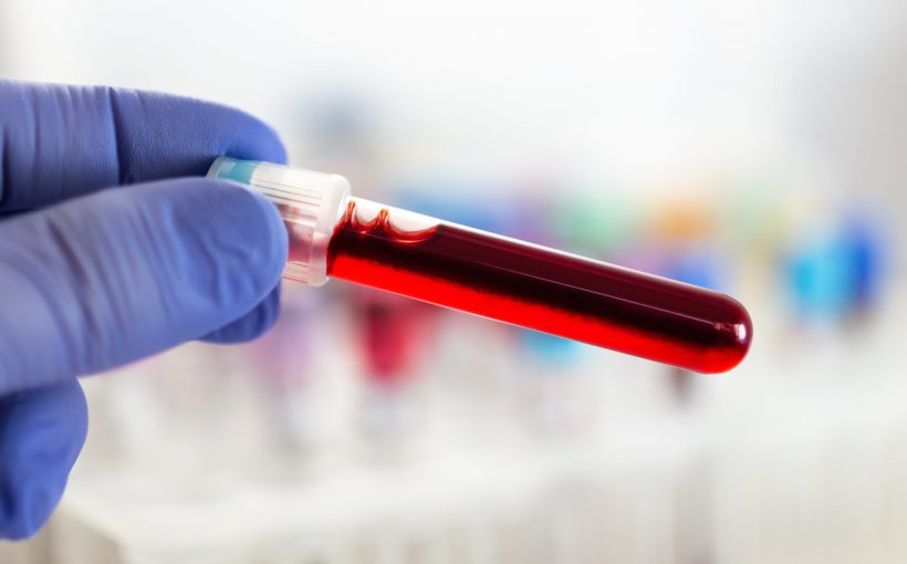 Analityk laboratoryjny trzyma w dłoni odzianej w sterylną rękawiczkę, fiolkę wypełnioną krwią pacjenta. /Źródło: 123rf.com