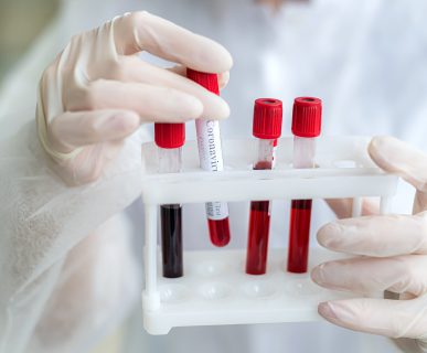 Analityk laboratoryjny trzyma w dłoni probówki z krwią pacjenta, w celu diagnostyki medycznej. /Źródło: 123rf.com
