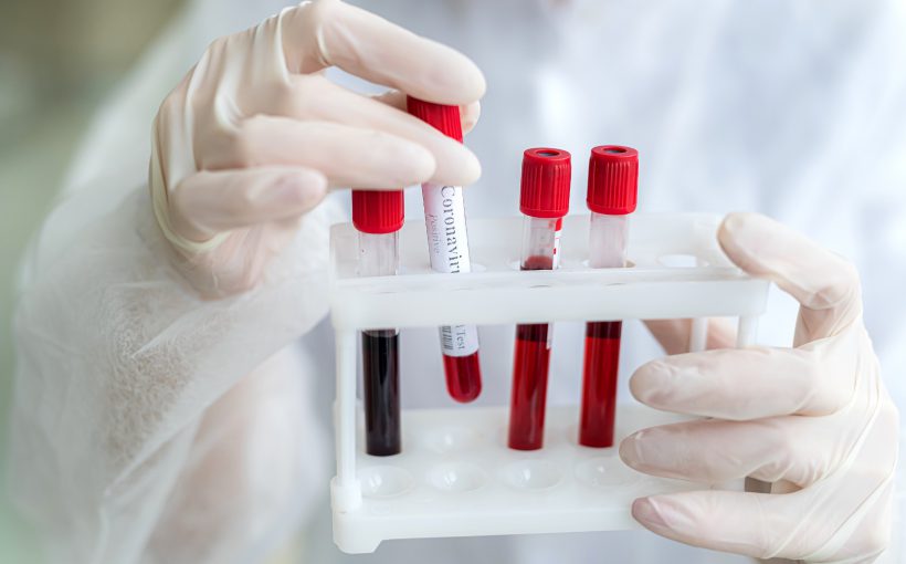 Analityk laboratoryjny trzyma w dłoni probówki z krwią pacjenta, w celu diagnostyki medycznej. /Źródło: 123rf.com