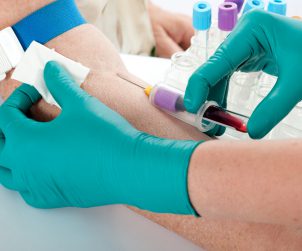 Pielęgniarka pobiera starszemu mężczyźnie krew z żyły u ręki, w celu przekazania próbki do analizy laboratoryjnej. /Źródło: 123rf.com