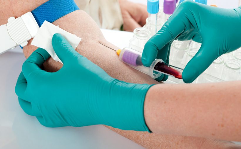 Pielęgniarka pobiera starszemu mężczyźnie krew z żyły u ręki, w celu przekazania próbki do analizy laboratoryjnej. /Źródło: 123rf.com