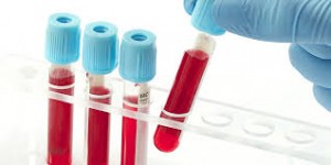 badania laboratoryjne krwi warszawa śródmieście