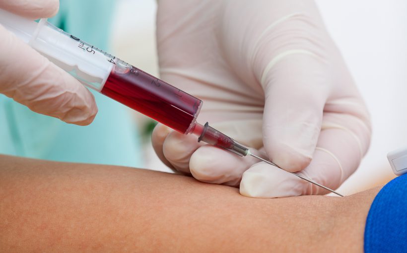 Pielęgniarka pobiera krew pacjentowi z żyły u ręki. /Źródło: 123rf.com