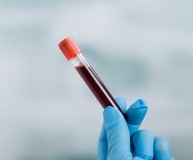 Analityk medyczny trzyma w dłoni odzianej w niebieską, sterylną rękawiczkę, fiolkę wypełnioną krwią, pobraną w celach diagnostycznych. /Źródło: 123rf.com