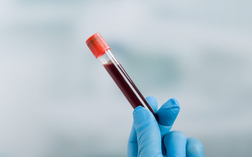 Analityk medyczny trzyma w dłoni odzianej w niebieską, sterylną rękawiczkę, fiolkę wypełnioną krwią, pobraną w celach diagnostycznych. /Źródło: 123rf.com