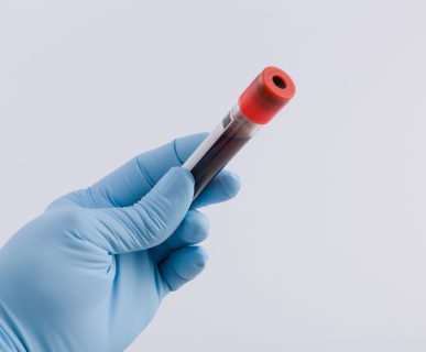 Analityk medyczny trzyma w dłoniach fiolkę wypełnioną krwią pacjenta. /Źródło: 123rf.com