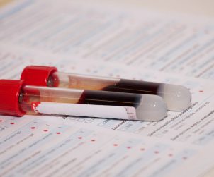 Dwie probówki wypełnione próbką krwi. /Źródło: 123rf.com