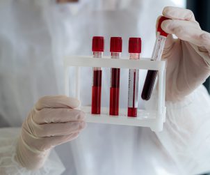 Analityk laboratoryjny ubrany w sterylny strój trzyma w dłoniach organizer z ułożonymi fiolkami wypełnionymi krwią do diagnostyki. /Źródło: 123rf.com