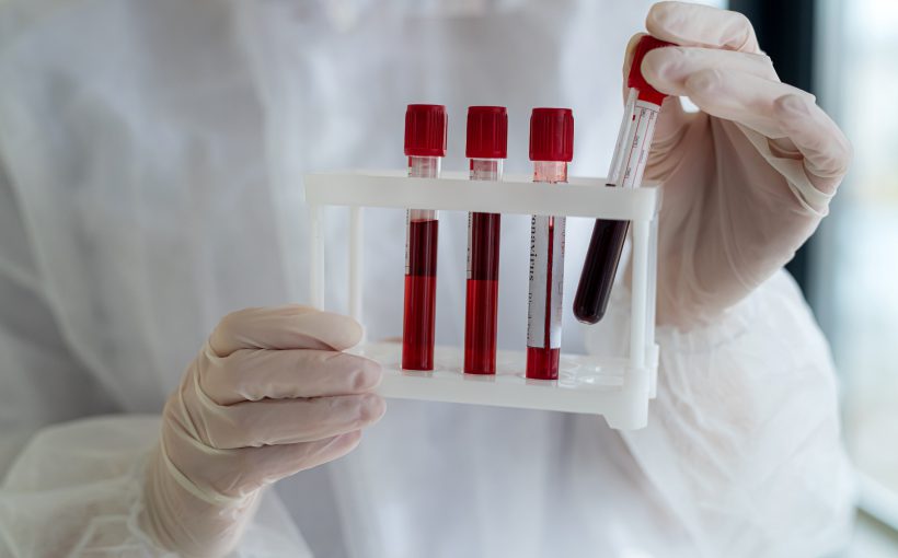Analityk laboratoryjny ubrany w sterylny strój trzyma w dłoniach organizer z ułożonymi fiolkami wypełnionymi krwią do diagnostyki. /Źródło: 123rf.com