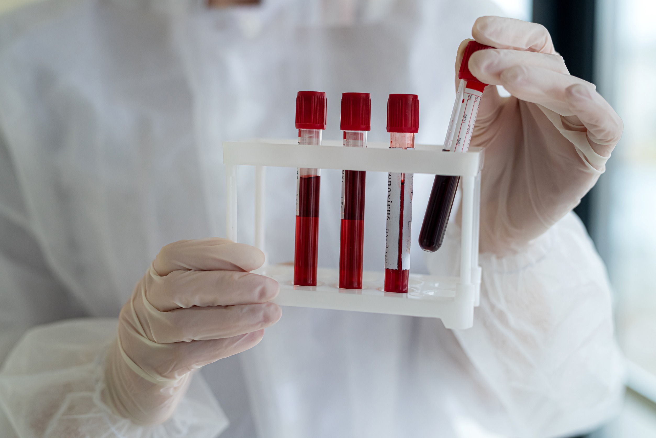 Analityk laboratoryjny ubrany w sterylny strój trzyma w dłoniach organizer z ułożonymi fiolkami wypełnionymi krwią do diagnostyki. /Źródło: 123rf.com