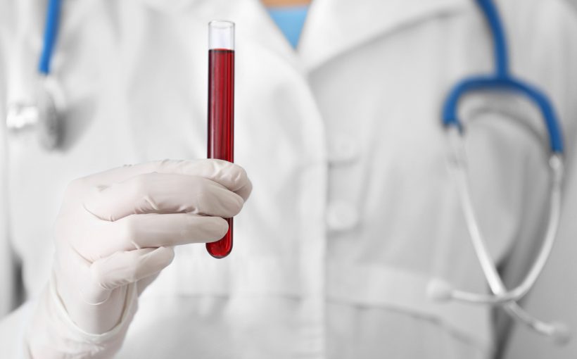 Pielęgniarz ubrany w biały strój medyczny, ze stetoskopem na szyi, trzyma w dłoni fiolkę wypełnioną krwią. /Źródło: 123rf.com