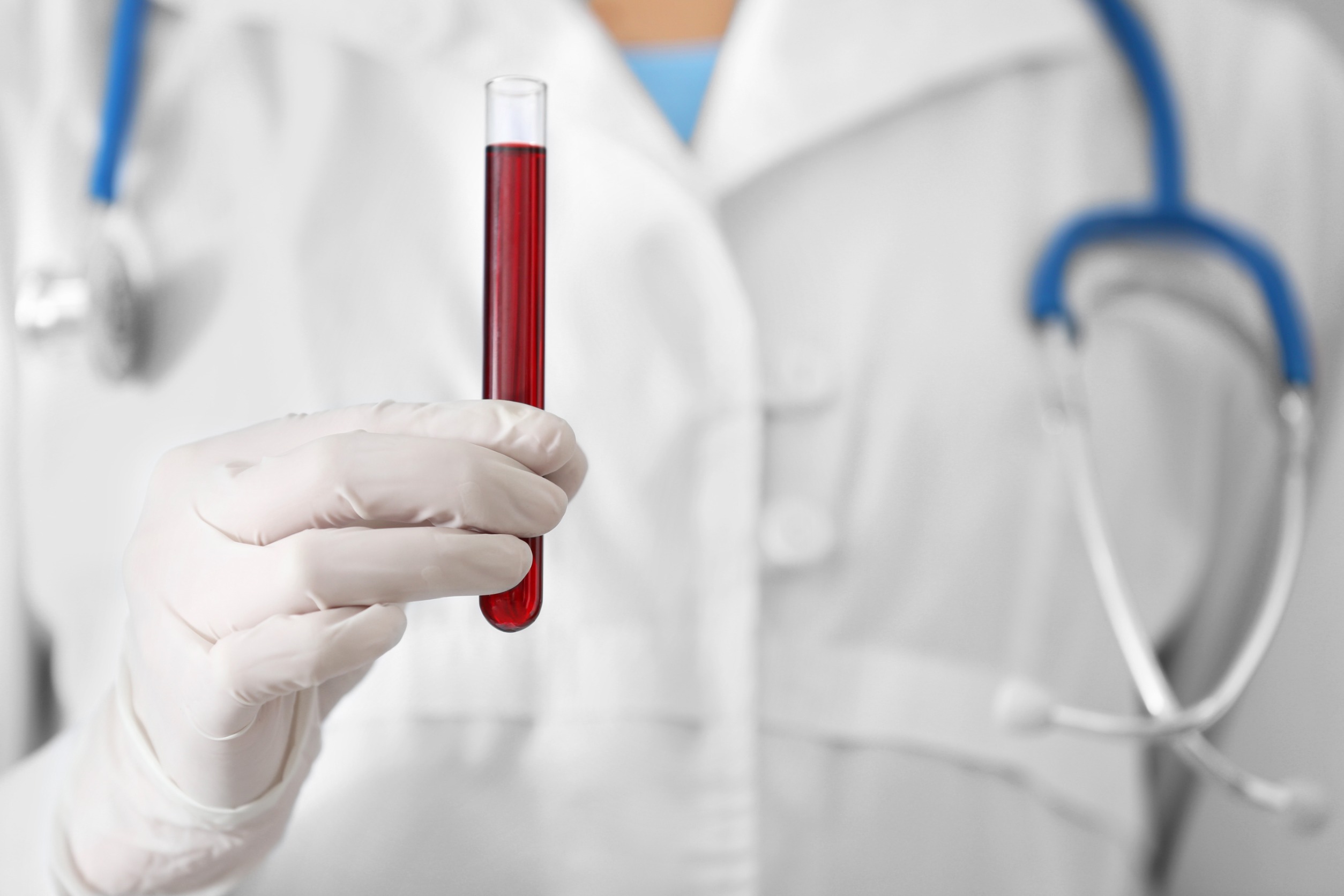 Pielęgniarz ubrany w biały strój medyczny, ze stetoskopem na szyi, trzyma w dłoni fiolkę wypełnioną krwią. /Źródło: 123rf.com