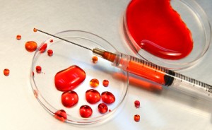 Blood in petri dish with syringe