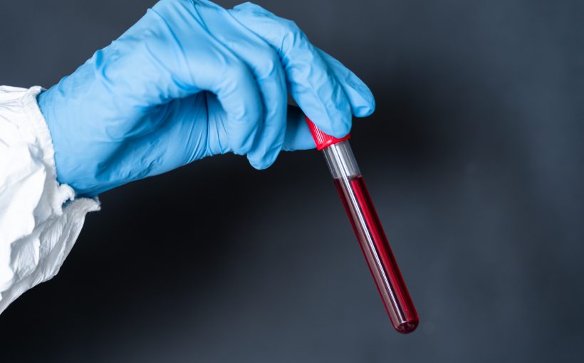 Analityk medyczny trzyma w dłoni odzianej w sterylną rękawiczkę fiolkę z próbką krwi pobraną pacjentowi, aby poddać ją diagnostyce laboratoryjnej. /Źródło: 123rf.com