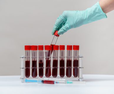 Technik medyczny odkłada probówkę z pobraną krwią żylną pacjenta do specjalnego organizera. /Źródło: 123rf.com