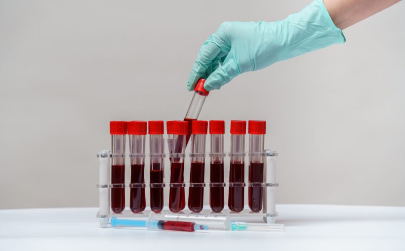 Technik medyczny odkłada probówkę z pobraną krwią żylną pacjenta do specjalnego organizera. /Źródło: 123rf.com