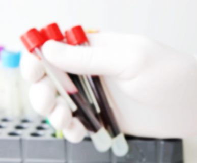 Analityk medyczny trzyma w dłoni trzy fiolki z krwią żylną pacjenta, aby poddać je diagnostyce laboratoryjnej. /Źródło: 123rf.com