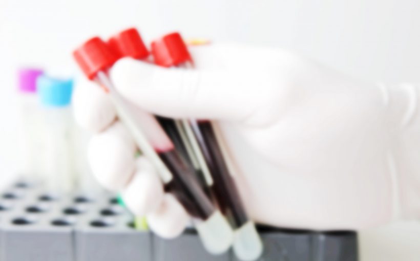 Analityk medyczny trzyma w dłoni trzy fiolki z krwią żylną pacjenta, aby poddać je diagnostyce laboratoryjnej. /Źródło: 123rf.com