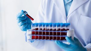 Analityk laboratoryjny trzyma w dłoniach pojemnik z uporządkowanymi probówkami z pobraną krwią pacjentów w celu diagnostyki. /Źródło: 123rf.com