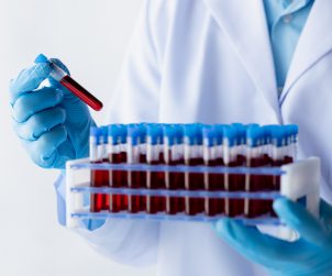 Analityk laboratoryjny trzyma w dłoniach pojemnik z uporządkowanymi probówkami z pobraną krwią pacjentów w celu diagnostyki. /Źródło: 123rf.com