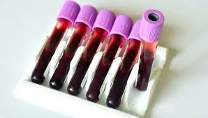 bełzyce badania krwi, cennik laboratorium