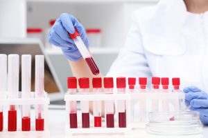 Analityk laboratoryjny bada próbki krwi, aby wykryć nieprawidłowości i choroby pacjentów. /Źródło: 123rf.com