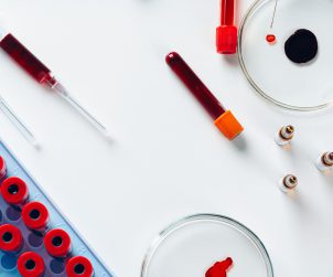 Narzędzia używane w celu pobrania krwi, fiolki z krwią pobraną w celu analizy i diagnostyki laboratoryjnej.