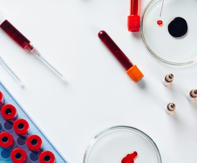 Narzędzia używane w celu pobrania krwi, fiolki z krwią pobraną w celu analizy i diagnostyki laboratoryjnej.