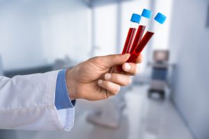 Analityk laboratoryjny trzyma w dłoni trzy probówki z krwią pobraną pacjentowi w celu diagnostyki. /Źródło: 123rf.com