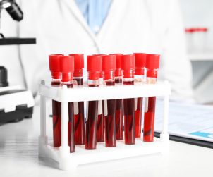 Probówki z pobraną krwią pacjentów, ułożone w białym organizerze. /Źródło: 123rf.com