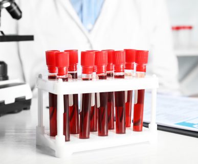 Probówki z pobraną krwią pacjentów, ułożone w białym organizerze. /Źródło: 123rf.com
