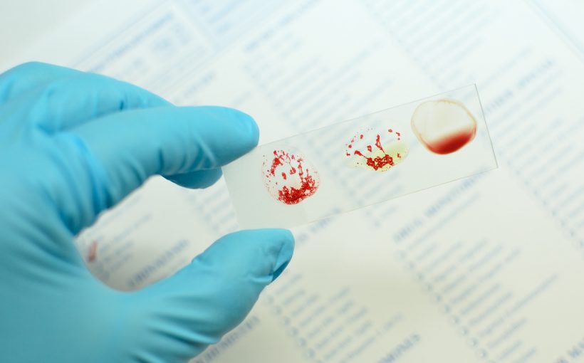 Analityk laboratoryjny trzyma w dłoni szkiełko z kroplami krwi, w celu określenia grupy krwi. /Źródło: 123rf.com