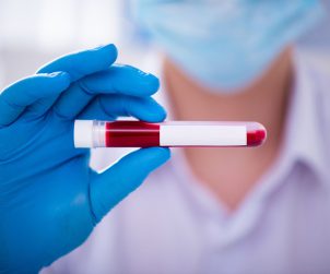 Technik laboratoryjny trzyma w dłoni odzianej w niebieską, sterylną rękawiczkę, fiolkę z krwią pacjenta. /Źródło: 123rf.com