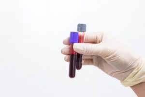 Pielęgniarka trzyma w dłoni dwie fiolki z krwią pobraną do celu analizy laboratoryjnej. /Źródło: 123rf.com