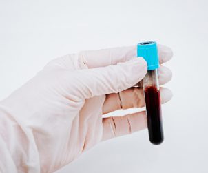 Analityk medyczny trzyma w dłoni odzianej w białą, sterylną rękawiczkę fiolkę z krwią pacjenta. /Źródło: 123rf.com