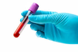 goleniów badania krwi, cennik laboratorium