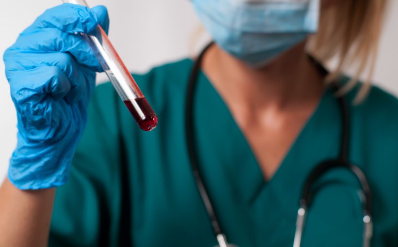 Młoda pielęgniarka w stroju medycznym trzyma w dłoniach fiolkę z krwią pacjenta. /Źródło: 123rf.com