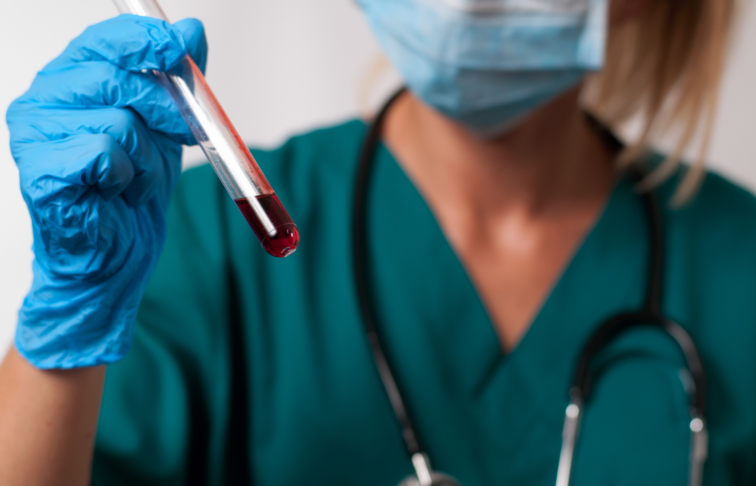 Młoda pielęgniarka w stroju medycznym trzyma w dłoniach fiolkę z krwią pacjenta. /Źródło: 123rf.com